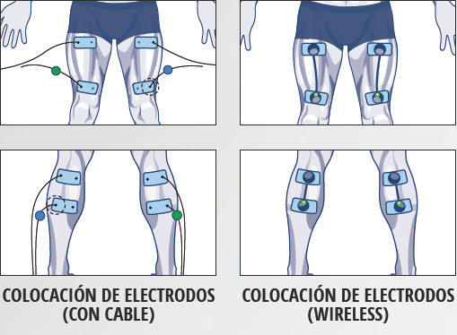 ⭕#1 COMPEX en CUÁDRICEPS - ¿Cómo se ponen los electrodos? Coloca bien los  parches del estimulador 