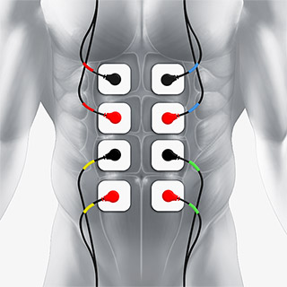 TENS Unit for Low Back and Sciatic Pain (Electrode Placement) 
