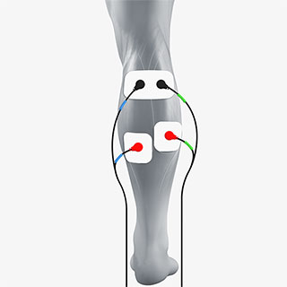 https://www.compex.com/media/wysiwyg/compex-usa/cms/electrode-placement/electrode-placement-calf-320x320.jpg