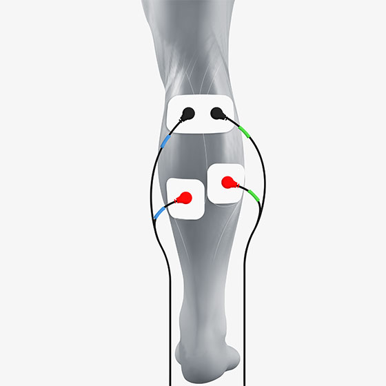https://www.compex.com/media/wysiwyg/compex-usa/cms/electrode-placement/electrode-placement-calf-560x560.jpg