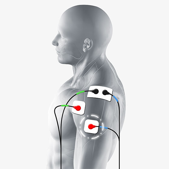 https://www.compex.com/media/wysiwyg/compex-usa/cms/electrode-placement/electrode-placement-deltoid-560x560.jpg