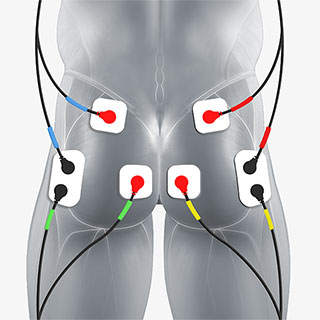 Electrode placement in TENS (a) and HF (b) treatment
